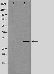 CCNC / Cyclin C Antibody - Western blot analysis of Cyclin C (Phospho-Ser275) expression in LOVO cells. The lane on the left is treated with the antigen-specific peptide.