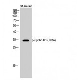 CCND1 / Cyclin D1 Antibody - Western blot of Phospho-Cyclin D1 (T286) antibody