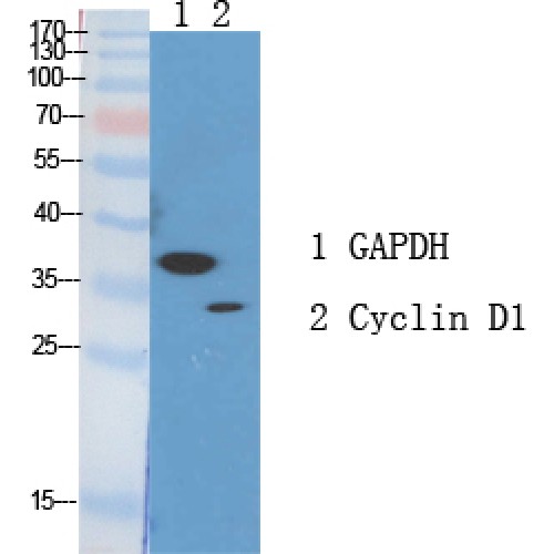 CCND1 / Cyclin D1 Antibody - Western blot of Cyclin D1 antibody