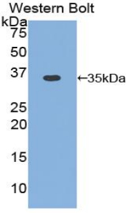 CCND1 / Cyclin D1 Antibody - Western blot of recombinant CCND1 / Cyclin D1.