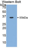 CCND1 / Cyclin D1 Antibody - Western blot of recombinant CCND1 / Cyclin D1.  This image was taken for the unconjugated form of this product. Other forms have not been tested.