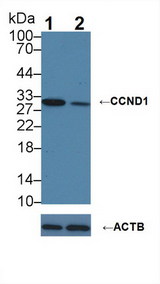 CCND1 / Cyclin D1 Antibody - Knockout Varification: Lane 1: Wild-type A549 cell lysate; Lane 2: CCND1 knockout A549 cell lysate; Predicted MW: 33kDa Observed MW: 30kDa Primary Ab: 1µg/ml Rabbit Anti-Human CCND1 Antibody Second Ab: 0.2µg/mL HRP-Linked Caprine Anti-Rabbit IgG Polyclonal Antibody