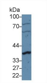 CCND1 / Cyclin D1 Antibody - Western Blot; Sample: Human U87MG cell lysate; Primary Ab: 5µg/ml Rabbit Anti-Rat CCND1 Antibody Second Ab: 0.2µg/mL HRP-Linked Caprine Anti-Rabbit IgG Polyclonal Antibody
