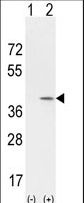 CCND1 / Cyclin D1 Antibody - Western blot of CCND1 (arrow) using rabbit polyclonal CCND1 Antibody. 293 cell lysates (2 ug/lane) either nontransfected (Lane 1) or transiently transfected with the CCND1 gene (Lane 2) (Origene Technologies).