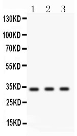 CCND1 / Cyclin D1 Antibody - Cyclin D1 antibody Western blot. All lanes: Anti Cyclin D1 at 0.5 ug/ml. Lane 1: Human Placenta Tissue Lysate at 50 ug. Lane 2: HELA Whole Cell Lysate at 40 ug. Lane 3: 293T Whole Cell Lysate at 40 ug. Predicted band size: 33 kD. Observed band size: 33 kD.