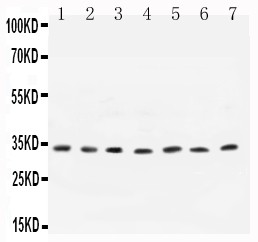 CCND1 / Cyclin D1 Antibody - Cyclin D1 antibody All Western blot. All lanes: Anti-CCND1 at 0.5 ug/ml. Lane 1: Rat Testis Tissue Lysate at 40 ug. Lane 2: Human Placenta Tissue Lysate at 40 ug. Lane 3: Rat Brain Tissue Lysate at 40 ug. Lane 4: MCF-7 Whole Cell Lysate at 40 ug. Lane 5: COLO320 Whole Cell Lysate at 40 ug. Lane 6: SW620 Whole Cell Lysate at 40 ug. Lane 7: MM231 Whole Cell Lysate at 40 ug. Predicted band size: 33 kD. Observed band size: 33 kD.