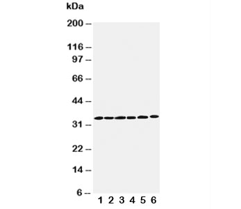 CCND1 / Cyclin D1 Antibody - Western blot testing of Cyclin D1 antibody and Lane 1: rat testis; 2: rat ovary; 3: rat brain; 4: HeLa; 5: MM231; 6: SW620 cell lysate