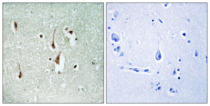 CCND1 / Cyclin D1 Antibody - Immunohistochemistry analysis of paraffin-embedded human brain tissue, using Cyclin D1 Antibody. The picture on the right is blocked with the synthesized peptide.