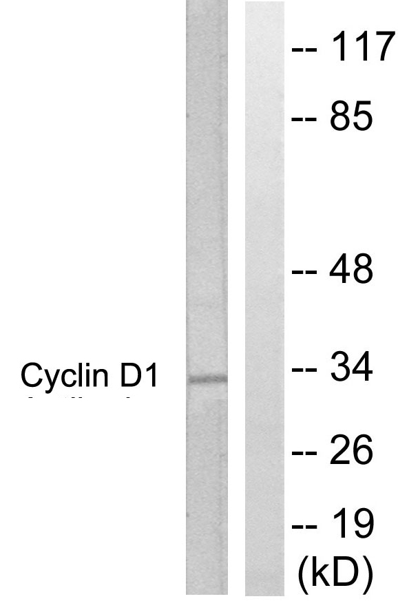 CCND1 / Cyclin D1 Antibody - Western blot analysis of lysates from Jurkat cells, treated with EGF 200ng/ml 30', using Cyclin D1 Antibody. The lane on the right is blocked with the synthesized peptide.