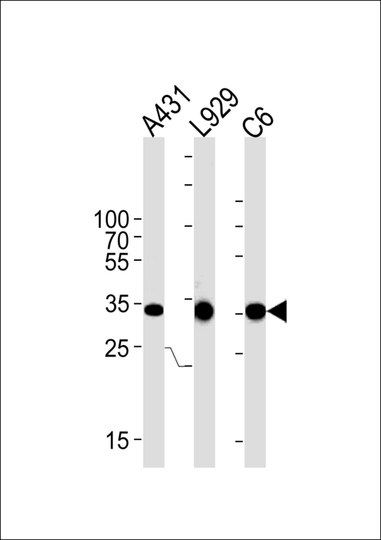 CCND1 / Cyclin D1 Antibody - CCND1 Antibody (T286) western blot of A431, mouse L929, rat C6 cell line lysates (35 ug/lane). The CCND1 antibody detected the CCND1 protein (arrow).