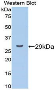 CCND1 / Cyclin D1 Antibody - Western blot of recombinant CCND1 / Cyclin D1.  This image was taken for the unconjugated form of this product. Other forms have not been tested.