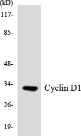 CCND1 / Cyclin D1 Antibody - Western blot analysis of the lysates from K562 cells using Cyclin D1 antibody.