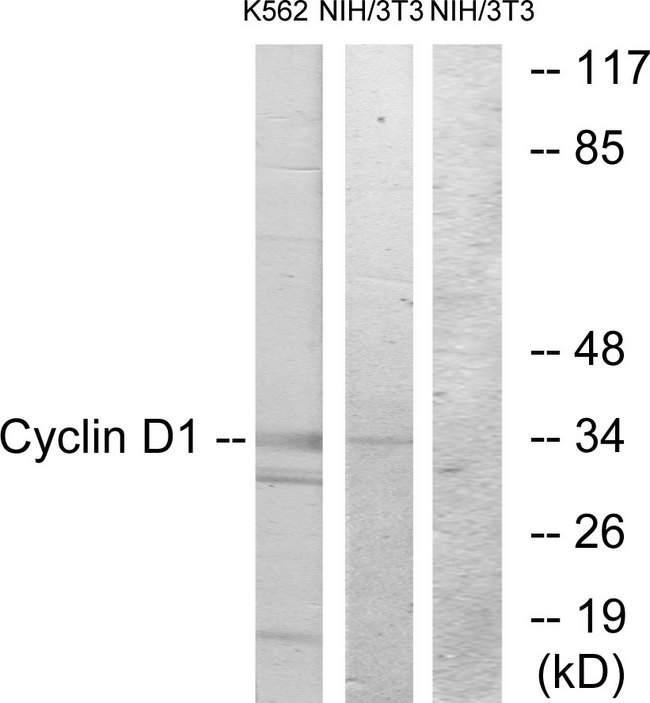 CCND1 / Cyclin D1 Antibody - Western blot analysis of lysates from K562 and NIH/3T3 cells, using Cyclin D1 Antibody. The lane on the right is blocked with the synthesized peptide.