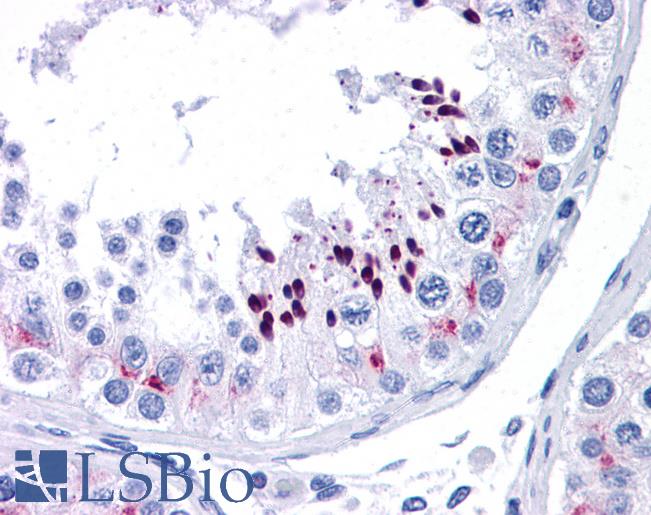 CCND1 / Cyclin D1 Antibody - Anti-CCND1 / Cyclin D1 antibody IHC of human testis. Immunohistochemistry of formalin-fixed, paraffin-embedded tissue after heat-induced antigen retrieval. Antibody concentration 5 ug/ml.  This image was taken for the unconjugated form of this product. Other forms have not been tested.