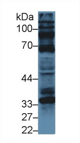 CCND1 / Cyclin D1 Antibody - Western Blot; Sample: Human U87MG cell lysate; Primary Ab: 5µg/ml Rabbit Anti-Bovine CCND1 Antibody Second Ab: 0.2µg/mL HRP-Linked Caprine Anti-Rabbit IgG Polyclonal Antibody