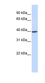CCND1 / Cyclin D1 Antibody - CCND1 / Cyclin D1 antibody western blot of 721_B cell lysate.  This image was taken for the unconjugated form of this product. Other forms have not been tested.