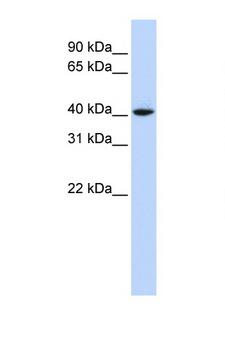 CCND1 / Cyclin D1 Antibody - CCND1 / Cyclin D1 antibody Western blot of 721_B Cell lysate. Antibody concentration 1 ug/ml. This image was taken for the unconjugated form of this product. Other forms have not been tested.