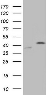 CCND1 / Cyclin D1 Antibody - HEK293T cells were transfected with the pCMV6-ENTRY control. (Left lane) or pCMV6-ENTRY CCND1. (Right lane) cDNA for 48 hrs and lysed. Equivalent amounts of cell lysates. (5 ug per lane) were separated by SDS-PAGE and immunoblotted with anti-CCND1.