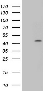 CCND1 / Cyclin D1 Antibody - HEK293T cells were transfected with the pCMV6-ENTRY control (Left lane) or pCMV6-ENTRY CCND1 (Right lane) cDNA for 48 hrs and lysed. Equivalent amounts of cell lysates (5 ug per lane) were separated by SDS-PAGE and immunoblotted with anti-CCND1.