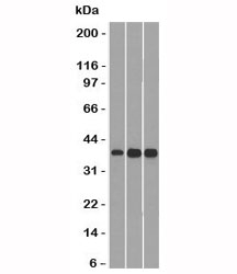 CCND1 / Cyclin D1 Antibody - Western blot testing of 1) human HepG2, 2) mouse NIH3T3 and 3) mouse C2C12 lysate with CCND1 antibody (clone SPM587).  This image was taken for the unmodified form of this product. Other forms have not been tested.