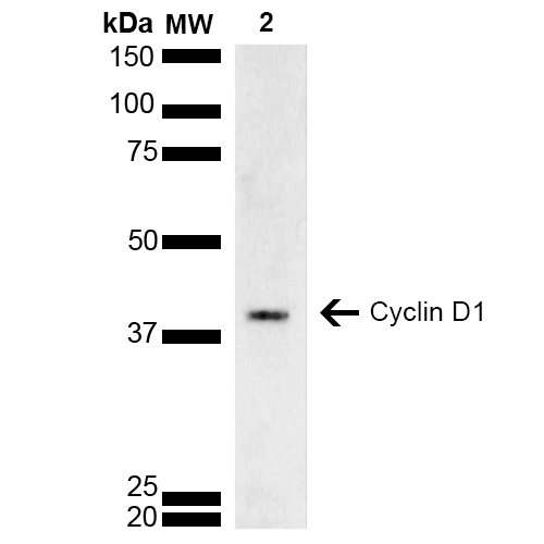 CCND1 / Cyclin D1 Antibody - Western blot analysis of Rat brain lysate showing detection of ~33.7 kDa Cyclin D1 protein using Rabbit Anti-Cyclin D1 Polyclonal Antibody. Lane 1: Molecular Weight Ladder (MW). Lane 2: Rat brain lysate. Load: 15 µg. Block: 5% Skim Milk in 1X TBST. Primary Antibody: Rabbit Anti-Cyclin D1 Polyclonal Antibody  at 1:1000 for 2 hours at RT. Secondary Antibody: Goat Anti-Rabbit HRP:IgG at 1:3000 for 1 hour at RT. Color Development: ECL solution for 5 min at RT. Predicted/Observed Size: ~33.7 kDa. Other Band(s): ~40 kDa due to post translational modifications.