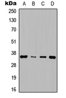 CCND1 / Cyclin D1 Antibody - Western blot analysis of Cyclin D1 expression in HepG2 (A); NIH3T3 (B); rat muscle (C); rat kidney (D) whole cell lysates.