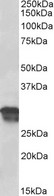 CCND1 / Cyclin D1 Antibody - Goat anti-cyclin D1 Antibody (0.5µg/ml) staining of Human Placenta lysate (35µg protein in RIPA buffer). Primary incubation was 1 hour. Detected by chemiluminescencence.