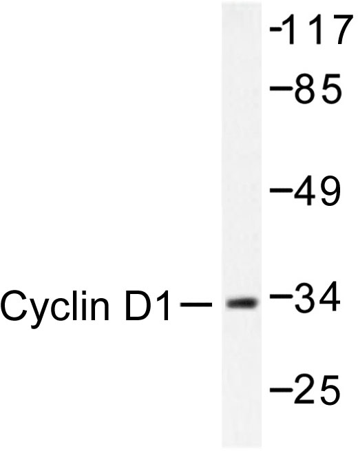 CCND1 / Cyclin D1 Antibody - Western blot of Cyclin D1 (L283) pAb in extracts from Jurkat cells.