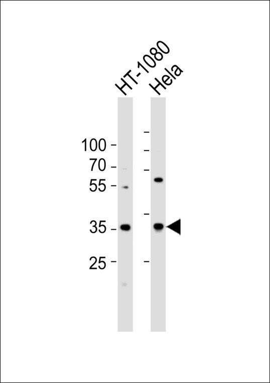 CCND1 / Cyclin D1 Antibody - Western blot of lysates from HT-1080,HeLa cell line (from left to right), using Anti-Cyclin D1 antibody(bs-0623R). bs-0623R was diluted at 1:1000 at each lane. A goat anti-rabbit IgG H&L (HRP) at 1:10000 dilution was used as the secondary antibody.Lysates at 20 ug per lane.