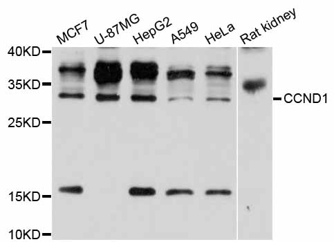 CCND1 / Cyclin D1 Antibody - Western blot analysis of extracts of various cell lines.