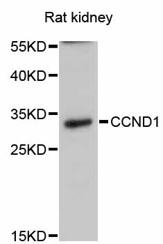 CCND1 / Cyclin D1 Antibody - Western blot analysis of extracts of rat kidney, using CCND1 antibody at 1:1000 dilution. The secondary antibody used was an HRP Goat Anti-Rabbit IgG (H+L) at 1:10000 dilution. Lysates were loaded 25ug per lane and 3% nonfat dry milk in TBST was used for blocking. An ECL Kit was used for detection and the exposure time was 90s.