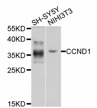 CCND1 / Cyclin D1 Antibody - Western blot analysis of extracts of various cell lines.