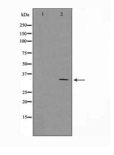 CCND1 / Cyclin D1 Antibody - Western blot of Cyclin D1 expression in MCF7 whole cell lysates,The lane on the left is treated with the antigen-specific peptide.
