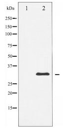 CCND1 / Cyclin D1 Antibody - Western blot of Cyclin D1 expression in K562 whole cell lysates,The lane on the left is treated with the antigen-specific peptide.