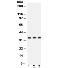 CCND1 / Cyclin D1 Antibody
