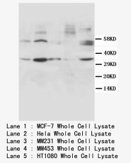 CCND1 / Cyclin D1 Antibody -  This image was taken for the unconjugated form of this product. Other forms have not been tested.