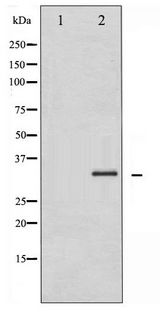 CCND1 / Cyclin D1 Antibody - Western blot of Cyclin D1 phosphorylation expression in K562 whole cell lysates,The lane on the left is treated with the antigen-specific peptide.