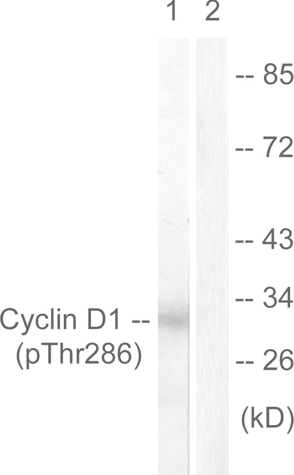 CCND1 / Cyclin D1 Antibody - Western blot analysis of lysates from Jurkat cells treated with EGF 200ng/ml 30', using Cyclin D1 (Phospho-Thr286) Antibody. The lane on the right is blocked with the phospho peptide.