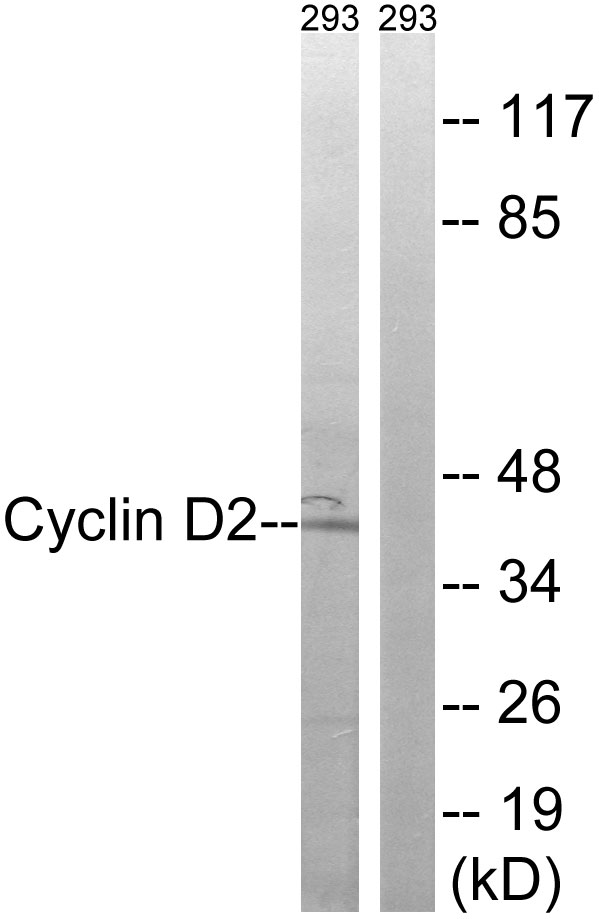 CCND2 / Cyclin D2 Antibody - Western blot analysis of lysates from 293 cells, using Cyclin D2 Antibody. The lane on the right is blocked with the synthesized peptide.