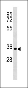 CCND2 / Cyclin D2 Antibody - CCND2 Antibody (C-term S279/T280) western blot of MDA-MB231 cell line lysates (35 ug/lane). The CCND2 antibody detected the CCND2 protein (arrow).