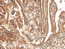 CCND2 / Cyclin D2 Antibody - Immunohistochemistry analysis using Rabbit Anti-Cyclin D2 Polyclonal Antibody. Tissue: Stomach. Species: Human. Fixation: Formalin Fixed Paraffin-Embedded. Primary Antibody: Rabbit Anti-Cyclin D2 Polyclonal Antibody  at 1:50 for 30 min at RT. Counterstain: Hematoxylin. Magnification: 10X. HRP-DAB Detection.