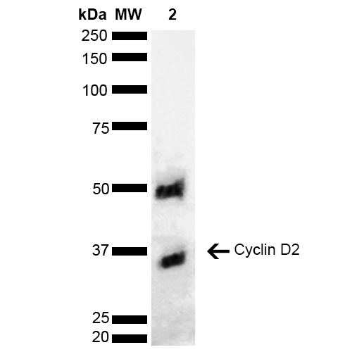 CCND2 / Cyclin D2 Antibody - Western blot analysis of Human Cervical cancer cell line (HeLa) lysate showing detection of ~33.1 kDa Cyclin D2 protein using Rabbit Anti-Cyclin D2 Polyclonal Antibody. Lane 1: Molecular Weight Ladder (MW). Lane 2: Cervical Cancer cell line (HeLa) lysate. Load: 10 µg. Block: 5% Skim Milk in 1X TBST. Primary Antibody: Rabbit Anti-Cyclin D2 Polyclonal Antibody  at 1:1000 for 2 hours at RT. Secondary Antibody: Goat Anti-Rabbit HRP:IgG at 1:3000 for 1 hour at RT. Color Development: ECL solution for 5 min at RT. Predicted/Observed Size: ~33.1 kDa. Other Band(s): ~50 kDa due to post translational modifications.