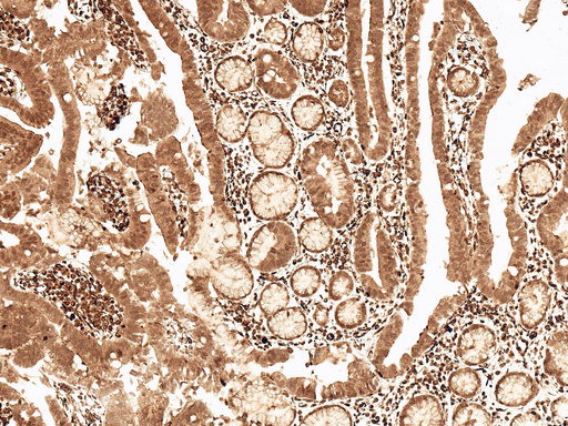 CCND2 / Cyclin D2 Antibody - Immunohistochemistry analysis using Rabbit Anti-Cyclin D2 Polyclonal Antibody. Tissue: Stomach. Species: Human. Fixation: Formalin Fixed Paraffin-Embedded. Primary Antibody: Rabbit Anti-Cyclin D2 Polyclonal Antibody  at 1:50 for 30 min at RT. Counterstain: Hematoxylin. Magnification: 10X. HRP-DAB Detection.