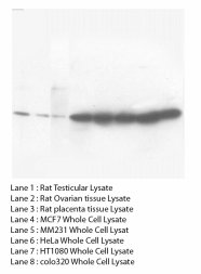 CCND2 / Cyclin D2 Antibody -  This image was taken for the unconjugated form of this product. Other forms have not been tested.