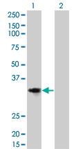 CCND2 / Cyclin D2 Antibody - Western Blot analysis of CCND2 expression in transfected 293T cell line by CCND2 monoclonal antibody (M01), clone 3B10.Lane 1: CCND2 transfected lysate(33.1 KDa).Lane 2: Non-transfected lysate.