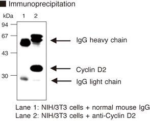 CCND2 / Cyclin D2 Antibody