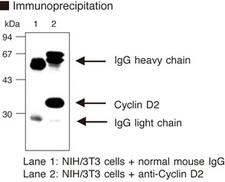 CCND2 / Cyclin D2 Antibody