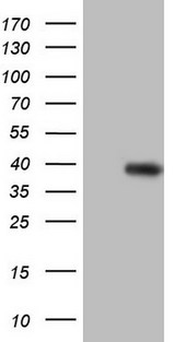 CCND2 / Cyclin D2 Antibody - HEK293T cells were transfected with the pCMV6-ENTRY control. (Left lane) or pCMV6-ENTRY CCND2. (Right lane) cDNA for 48 hrs and lysed. Equivalent amounts of cell lysates. (5 ug per lane) were separated by SDS-PAGE and immunoblotted with anti-CCND2.