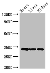 CCND2 / Cyclin D2 Antibody - Positive WB detected in:Mouse heart tissue,Mouse liver tissue,Mouse kidney tissue;All lanes:CCND2 antibody at 3.5ug/ml;Secondary;Goat polyclonal to rabbit IgG at 1/50000 dilution;Predicted band size: 34,25 kDa;Observed band size: 34 kDa;