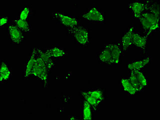 CCND2 / Cyclin D2 Antibody - Immunofluorescent analysis of HepG2 cells using CCND2 Antibody at a dilution of 1:100 and Alexa Fluor 488-congugated AffiniPure Goat Anti-Rabbit IgG(H+L)